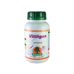 Vitiligon