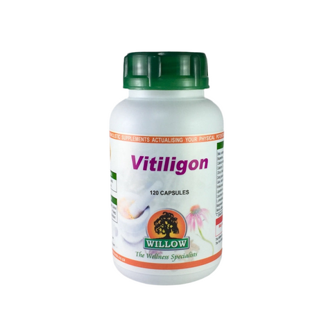 Vitiligon